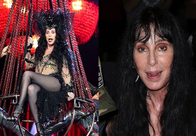 Twarz Cher zaczyna się rozpadać?!