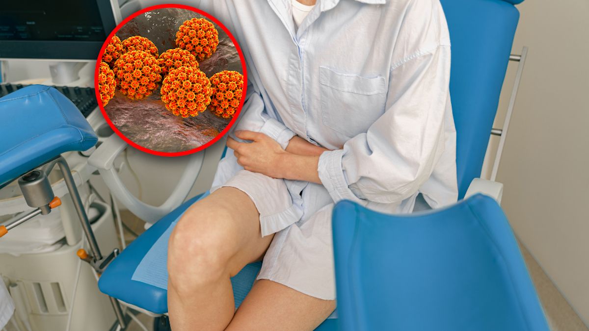 Nowotwór rozwija się podstępnie