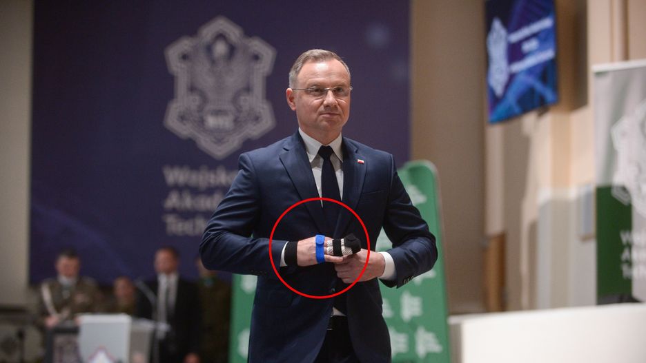 Andrzej Duda doznał kontuzji