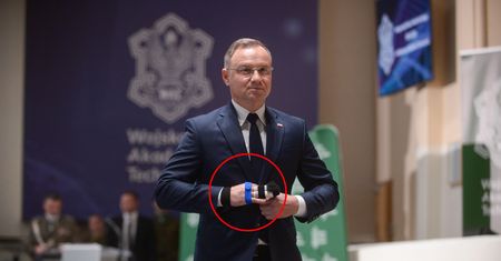 Kontuzja prezydenta. Nieoficjalna przyczyna