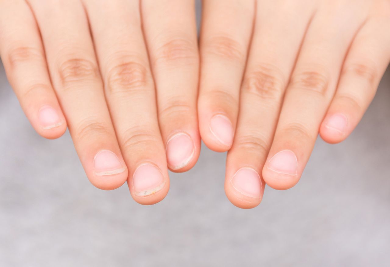 Warning signs: How your nails reveal hidden heart problems