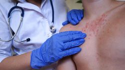 Eksperci alarmują przed powrotem epidemii. Polacy lekceważą profilaktykę