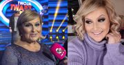 Katarzyna Skrzynecka zapewnia, że NIE PRZERABIA zdjęć w Photoshopie: "Nie znam tego programu i nie wyszczuplam sobie twarzy" (WIDEO)