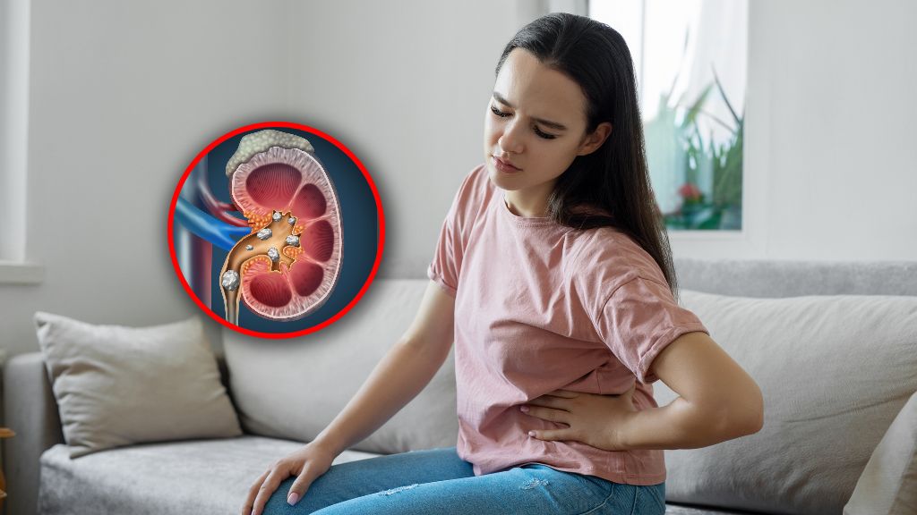 Kamicę nerkową przynajmniej raz w życiu przechodzi około 10 proc. dorosłych