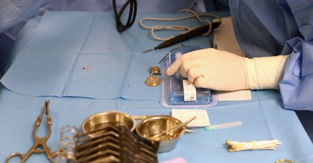 Koszmar na sali operacyjnej. Dawca narządów nagle zaczął płakać