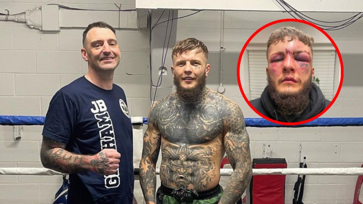 Jordan Vucenic mocno ucierpiał podczas ostatniej walki