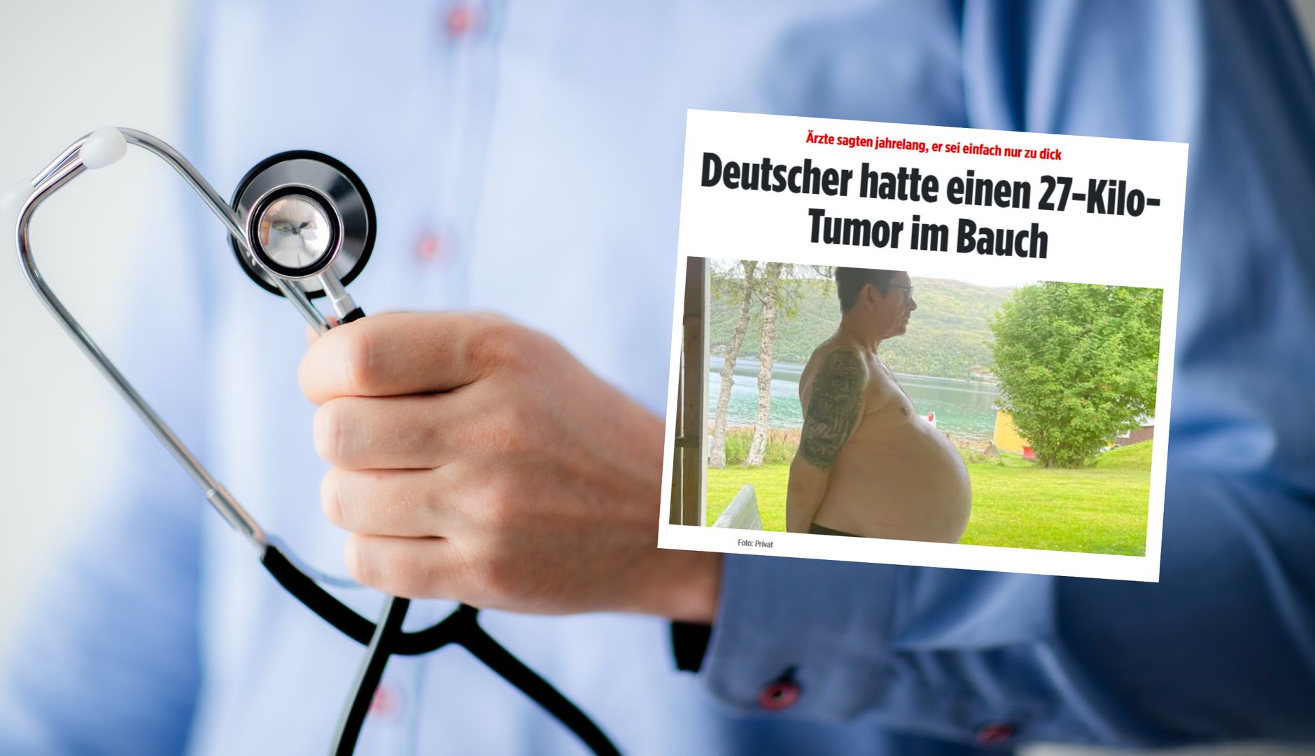 Przez 12 lat rósł mu brzuch. Druzgocąca diagnoza