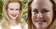 Twarz Nicole Kidman w Cannes! STRASZNA?