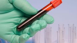 6 nietypowych rzeczy, o których możesz dowiedzieć się z testu krwi