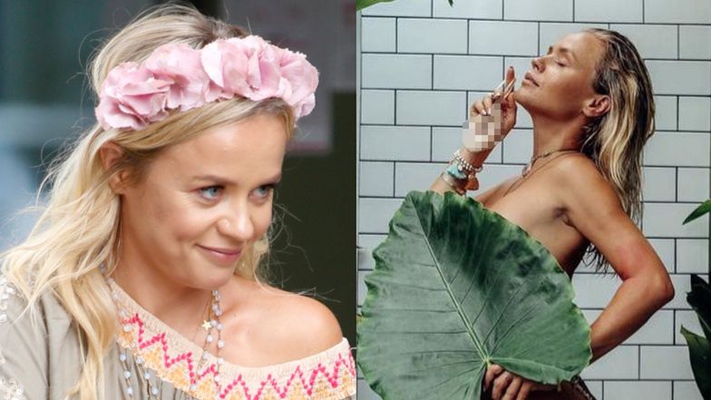 Rozebrana Anna Skura chwali się pooperacyjnymi bliznami