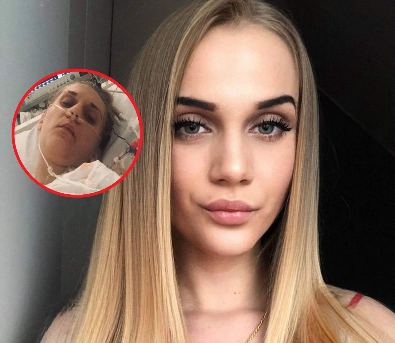 24-latka przeszła kilkanaście cykli chemii