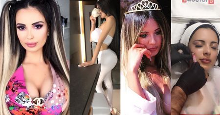 Była modelka Versace jest GOTOWA UMRZEĆ dla wyglądu... "Przynajmniej umrę piękna i szczęśliwa"
