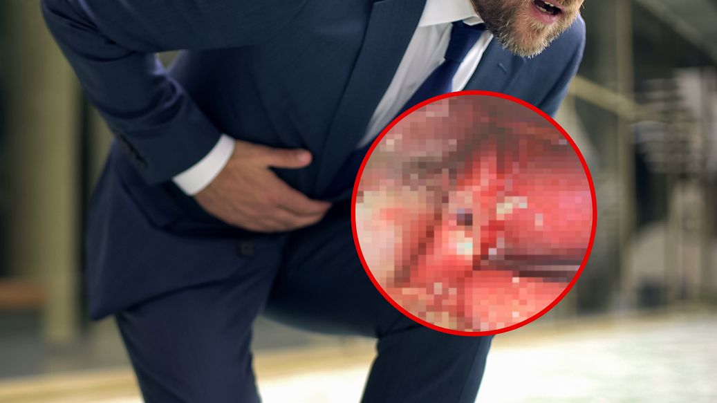 Połączenie alkoholu z ibuprofenem może mieć dramatyczne skutki