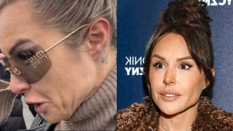 Blanka Lipińska znów OSTRZEGA przed Ozempikiem. Pokazała, co stało się z jej twarzą: "Po to są filtry w social mediach"