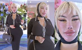 Jessica Alves straszy OPUCHNIĘTYM licem po liftingu w Turcji (ZDJĘCIA)