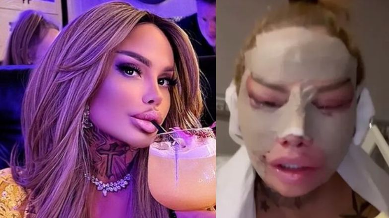 Laluna Unique znów majstrowała przy twarzy