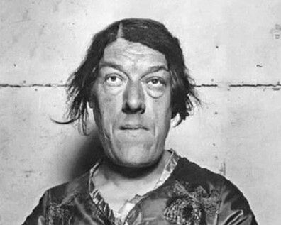 Choroba zmieniła drastycznie rysy twarzy Mary Ann Bevan