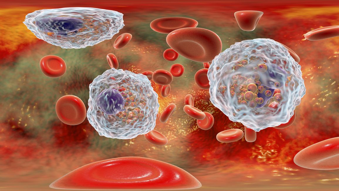 Granulocyty to rodzaj leukocytów (krwinek białych).