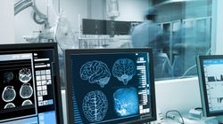 Podstępna choroba. Ciche objawy guza mózgu