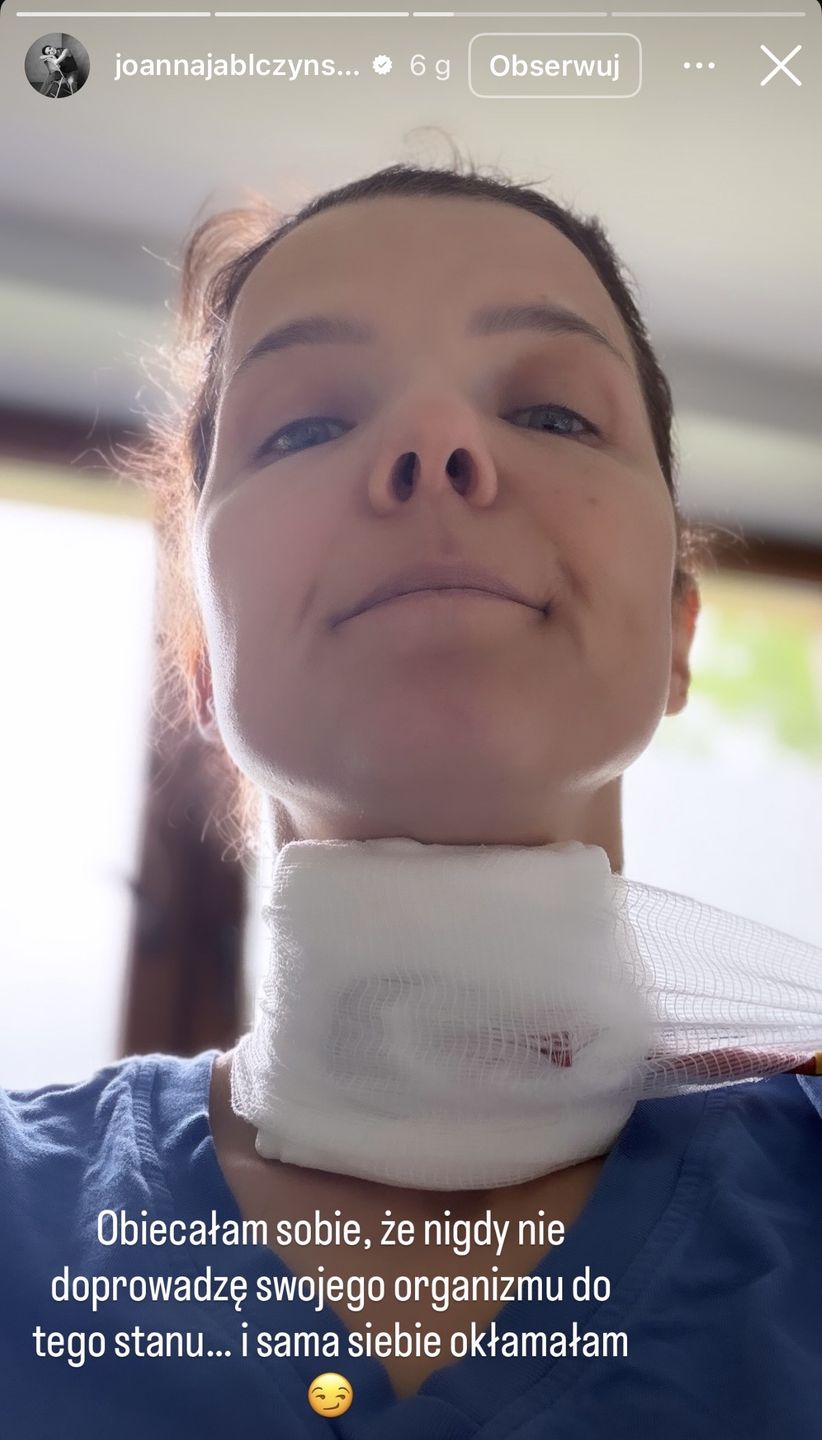 Joanna Jabłczyńska pokazała opatrunek 