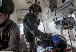 Gangrena wraca na front. "Powikłania, jakich nie widział nikt żyjący"