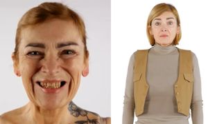 Schudła 50 kg, a przez 20 lat UNIKAŁA DENTYSTY. Uczestniczka programu Małgorzaty Rozenek zmieniła się NIE DO POZNANIA (ZDJĘCIA)