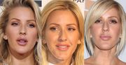 Ellie Goulding "poprawiła sobie" usta? (FOTO)