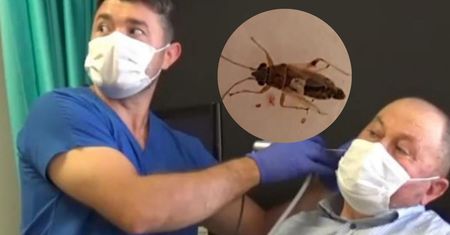 Brzęczenie w uchu nie dawało mu spokoju. Nie spodziewał się, co lekarz w nim znajdzie