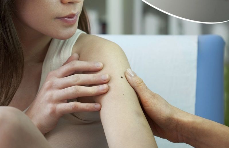 Istnieje wiele sposobów na pozbycie się blizn po oparzeniach