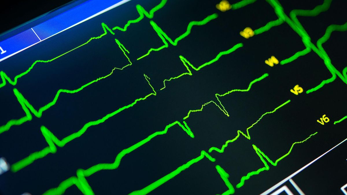 Echo serca - charakterystyka, rodzaje