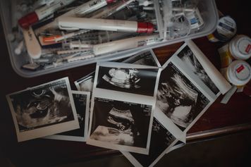 AI na tropie plemników. Szansa na przełom w leczeniu męskiej niepłodności