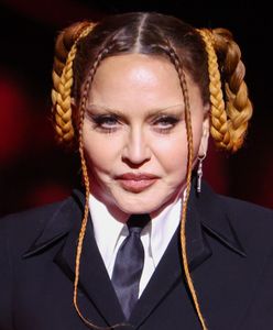 Madonna ma dość. Komentuje aferę wokół swojego wyglądu