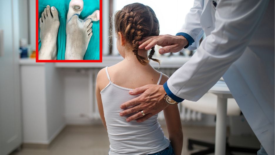 Ogromne palce stóp uniemożliwiały jej chodzenie. Dziewczynka cierpi na rzadką chorobę