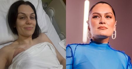 Jessie J przemówiła do fanów po mastektomii. Zdobyła się nawet na żart. "Sutek wrócił na swoje miejsce"