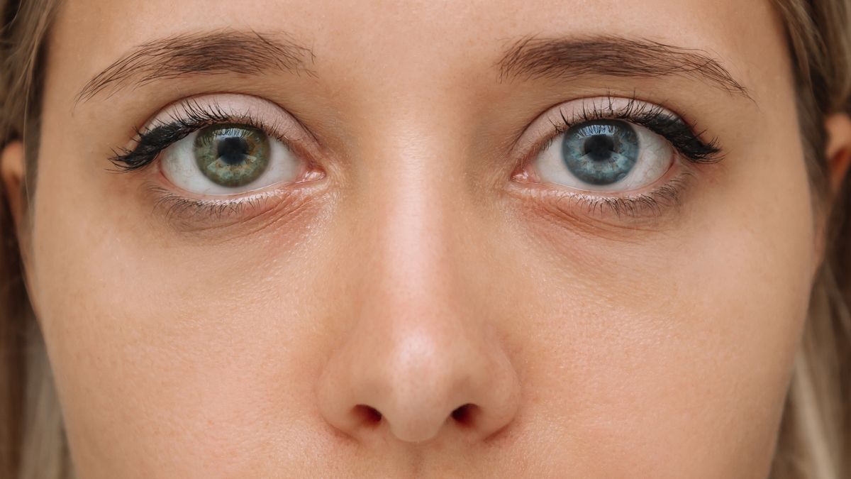 Young woman's face with with eyes of different colors green and blue. Sectoral heterochromia
Cropped shot of a young woman's face with with eyes of different colors: green and blue. Close up of lenses of various colors. Sectoral heterochromia, a genetic trait
Marina Demeshko