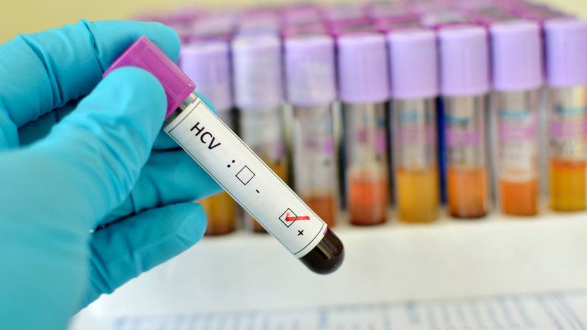 W wielu przypadkach HCV przebiega bezobjawowo