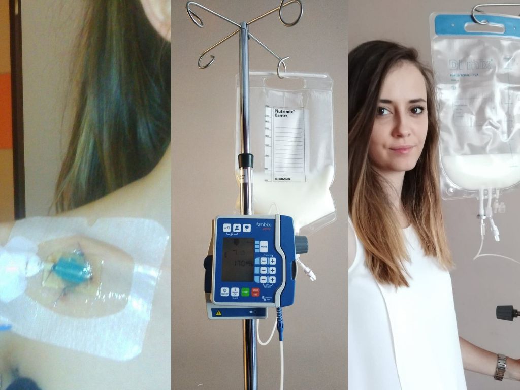 Ania przez 19 godzin podłączona jest do kroplówki