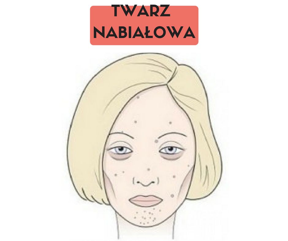 TWARZ NABIAŁOWA
