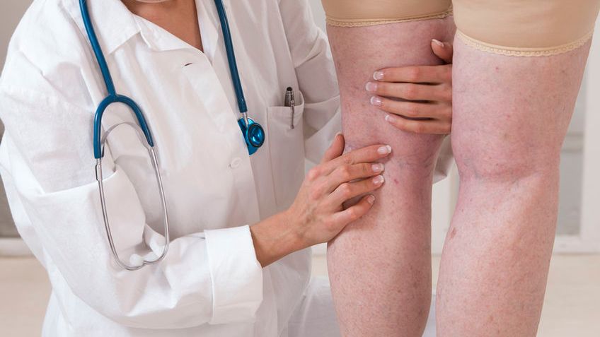 Opuchnięte nogi mogą być objawem wielu chorób