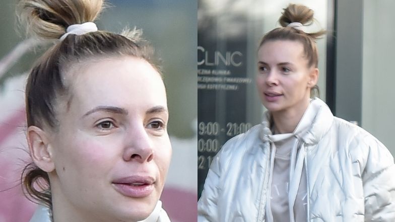 Izabela Janachowska bez makijażu mknie do kliniki stomatologii estetycznej