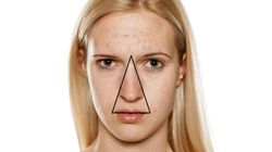 Trójkąt śmierci na twarzy. Wyjaśniamy, gdzie się znajduje