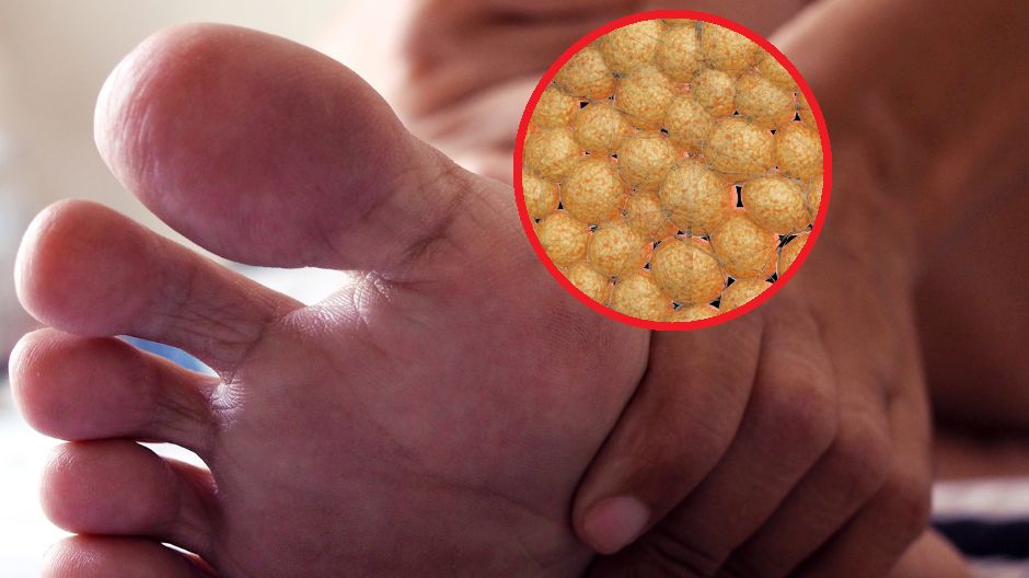 Jakie są objawy wysokiego cholesterolu?