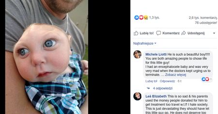 Historia tego dziecka inspirowała miliony. Jaxon zmarł w wieku pięciu lat