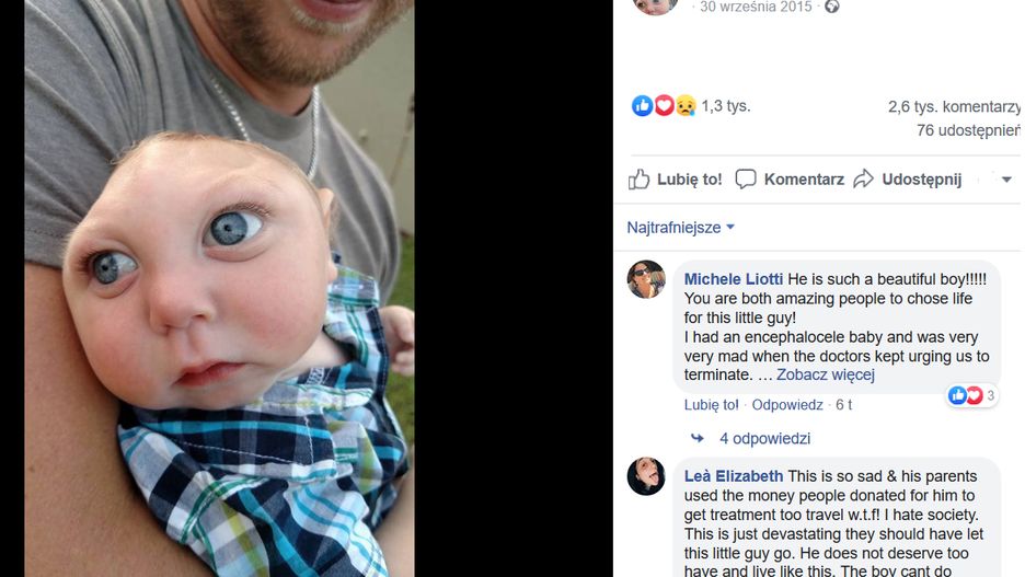 Historia tego dziecka inspirowała miliony. Jaxon zmarł w wieku pięciu lat