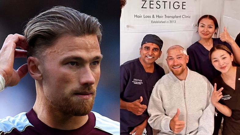 Matty Cash pochwalił się przeszczepem włosów