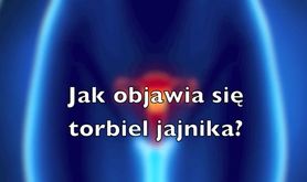 Jak objawia się torbiel jajnika? (WIDEO)