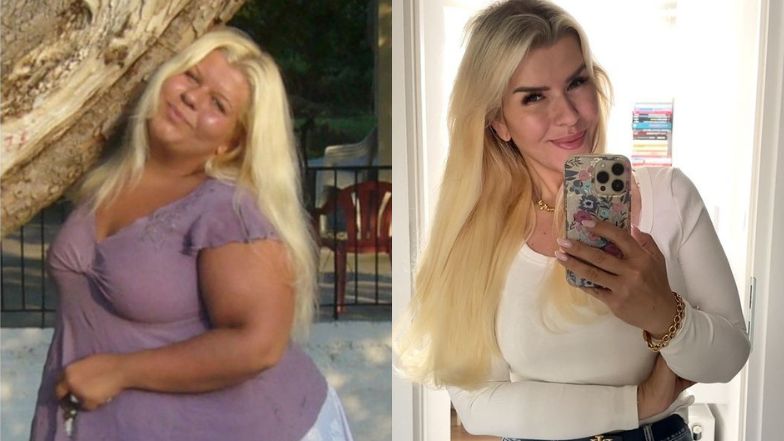 Schudła 100 kg. Dziś zachwyca szczupłą sylwetką