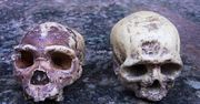 Niektóre wady rozwojowe mózgu odziedziczyliśmy po neandertalczykach