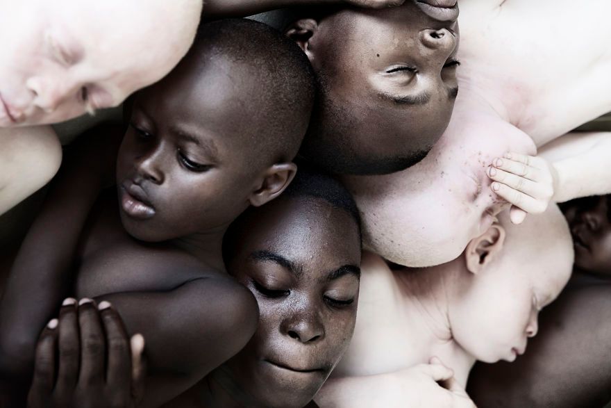 Wyjątkowe zdjęcia albinosów pomagają zwrócić uwagę na ich trudną sytuację w Tanzanii 3