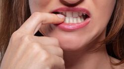 Nie tylko cukier. Zobacz, co naprawdę niszczy twoje zęby